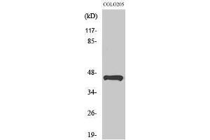 Western Blotting (WB) image for anti-Tumor Suppressor Candidate 3 (TUSC3) (Internal Region) antibody (ABIN3185751) (TUSC3 antibody  (Internal Region))