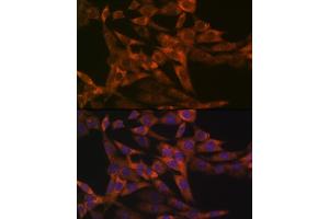 Immunofluorescence (IF) image for anti-Interferon Regulatory Factor 6 (IRF6) antibody (ABIN1680921)