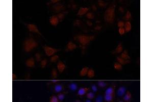 Immunofluorescence analysis of HeLa cells using MAPRE1 Polyclonal Antibody at dilution of 1:100. (MAPRE1 antibody)
