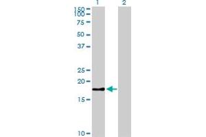 Survivin antibody  (AA 1-100)