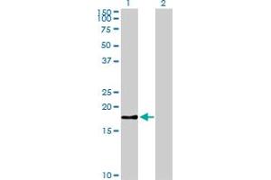 Western Blot analysis of BIRC5 expression in transfected 293T cell line by BIRC5 monoclonal antibody (M01), clone 5B10. (Survivin antibody  (AA 1-100))