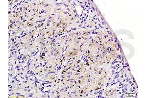 Formalin-fixed and paraffin embedded rat uterine myoma labeled with Rabbit Anti-ER-beta Polyclonal Antibody (ABIN725735) at 1:200 followed by conjugation to the secondary antibody and DAB staining. (TACR3 antibody  (AA 151-250))