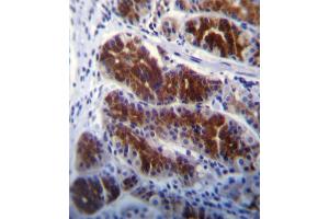 FRK Antibody (N-term) (ABIN392097 and ABIN2841849) immunohistochemistry analysis in formalin fixed and paraffin embedded human stomach tissue followed by peroxidase conjugation of the secondary antibody and DAB staining. (FRK antibody  (N-Term))