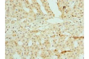 Immunohistochemistry of paraffin-embedded human adrenal gland tissue using ABIN7176016 at dilution of 1:100
