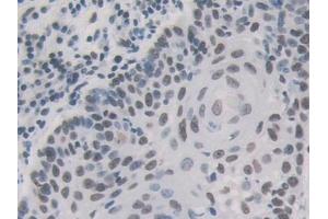 Immunohistochemistry (IHC) image for anti-Heterogeneous Nuclear Ribonucleoprotein A1 (HNRNPA1) (AA 2-372) antibody (ABIN7443554)
