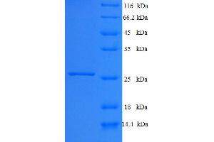 SDS-PAGE (SDS) image for Ephrin B3 (EFNB3) (AA 28-227) protein (His tag) (ABIN5709447) (Ephrin B3 Protein (EFNB3) (AA 28-227) (His tag))