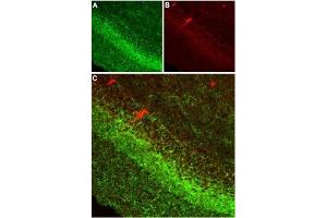 Expression of CB1 receptor in rat hippocampus - Immunohistochemical staining of rat hippocampus using Anti-Cannabinoid Receptor 1 (extracellular) Antibody (ABIN7043023, ABIN7044155 and ABIN7044156) (1:100). (CNR1 antibody  (Extracellular, N-Term))