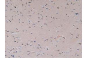 IHC-P analysis of Human Brain Tissue, with DAB staining. (TLR9 antibody  (AA 28-362))