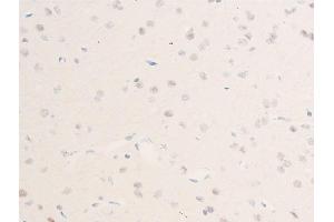 Immunohistochemistry (IHC) image for anti-Checkpoint Kinase 1 (CHEK1) (pSer301) antibody (ABIN6256255)