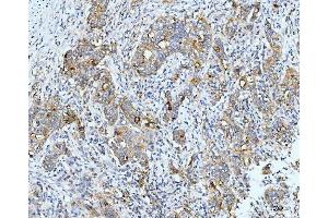 IHC analysis of Neurofibromin/NF1 using anti-Neurofibromin/NF1 antibody (ABIN7600197).