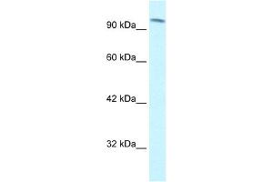 WB Suggested Anti-SMARCC1 Antibody Titration: 1. (SMARCC1 antibody  (C-Term))