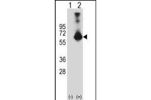 Western blot analysis of CBS (arrow) using rabbit polyclonal CBS Antibody (N-term) (ABIN1881141 and ABIN2841140). (CBS antibody  (N-Term))