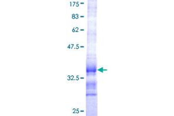 HSD17B12 Protein (AA 203-271) (GST tag)