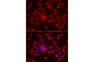 Immunofluorescence analysis of A549 cells using GORASP1 antibody (ABIN5973972). (GORASP1 antibody)