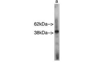 Image no. 1 for anti-Sterile alpha Motif Domain Containing 8 (SAMD8) antibody (ABIN793629) (SAMD8 antibody)