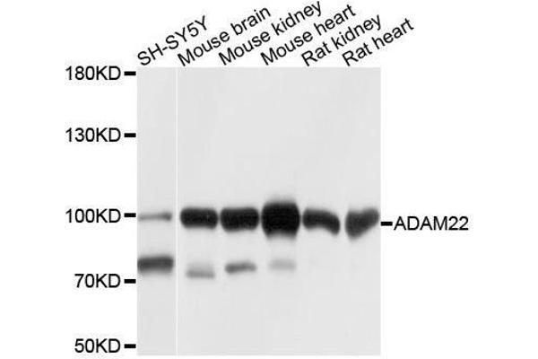 ADAM22 anticorps  (AA 223-400)