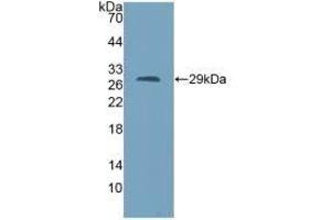 Detection of Recombinant AGA, Mouse using Polyclonal Antibody to Aspartylglucosaminidase (AGA) (AGA antibody  (AA 24-260))