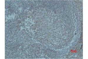 Immunohistochemistry (IHC) analysis of paraffin-embedded Human Tonsil Tissue using HIF-1beta Polyclonal Antibody. (ARNT antibody)