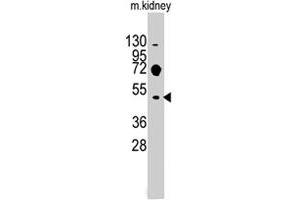 Western blot analysis of Evx2 polyclonal antibody  in mouse kidney tissue lysates (35 ug/lane). (EVX2 antibody  (C-Term))