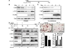 Western Blotting (WB) image for anti-COL1A2/COL1A1 antibody (ABIN5596819)