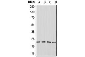 Western blot analysis of SEI-1 expression in MOLT4 (A), Jurkat (B), SP2/0 (C), PC12 (D) whole cell lysates. (SERTAD1 antibody  (Center))
