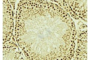 ABIN6276700 at 1/100 staining Mouse testis tissue by IHC-P. (HDAC9 antibody  (C-Term))