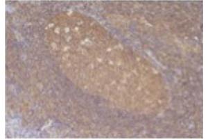 Image no. 1 for anti-Chemokine (C-C Motif) Ligand 5 (CCL5) antibody (ABIN465158) (CCL5 antibody)