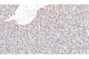 Detection of SEMA3A in Human Liver Tissue using Monoclonal Antibody to Semaphorin 3A (SEMA3A)