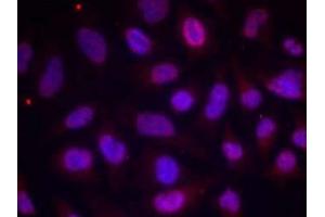 Immunofluorescence staining of methanol-fixed HeLa cells using MEF2A (phospho-Thr312) antibody (E011039, Red) (MEF2A antibody  (pThr312))