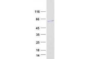 Family with Sequence Similarity 83, Member A (FAM83A) (Transcript Variant 1) protein (Myc-DYKDDDDK Tag)