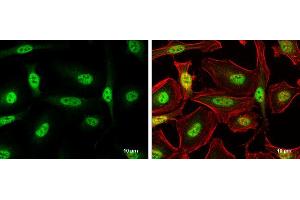 ICC/IF Image FOXO3A antibody [C3], C-term detects FOXO3A protein at nucleus by immunofluorescent analysis. (FOXO3 antibody  (C-Term))