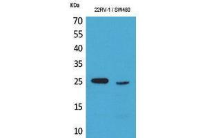 Western Blotting (WB) image for anti-Synovial Sarcoma, X Breakpoint 2B (SSX2B) (C-Term) antibody (ABIN3178216) (Synovial Sarcoma, X Breakpoint 2B (SSX2B) (C-Term) antibody)