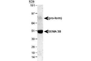 Western blot analysis of SEMA3B in mouse E16 cerebellum lysate with SEMA3B polyclonal antibody .