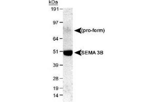 SEMA3B anticorps  (AA 100-200)