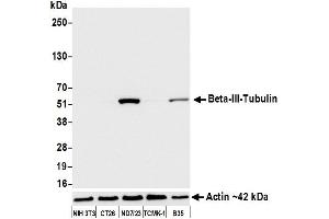 Western Blotting (WB) image for anti-Tubulin, beta 3 (TUBB3) (AA 400-450) antibody (ABIN7453957) (Recombinant TUBB3 antibody  (AA 400-450))