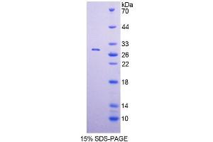 SDS-PAGE analysis of Human POLa1 Protein. (POLA1 Protein)