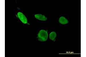 Immunofluorescence of monoclonal antibody to ERF on HeLa cell. (ERF antibody  (AA 181-290))