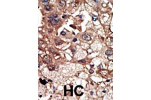 Immunohistochemistry (IHC) image for anti-Epidermal Growth Factor Receptor Pathway Substrate 8 (EPS8) antibody (ABIN3003718)