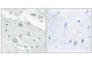 Immunohistochemistry (IHC) image for anti-Janus Kinase 1 (JAK1) (N-Term) antibody (ABIN1849256) (JAK1 antibody  (N-Term))