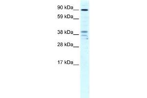 Human Liver; WB Suggested Anti-ZC3H7B Antibody Titration: 4ug/ml. (ZC3H7B antibody  (N-Term))