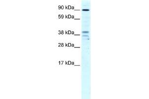 Human Liver; WB Suggested Anti-ZC3H7B Antibody Titration: 4ug/ml. (ZC3H7B antibody  (N-Term))