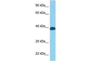 Host:  Rabbit  Target Name:  FOS  Sample Tissue:  Human PANC1 Whole Cell  Antibody Dilution:  1ug/ml (c-FOS antibody  (N-Term))