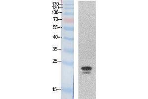 Western Blotting (WB) image for anti-Sex Determining Region Y (SRY) (Internal Region) antibody (ABIN3181048)