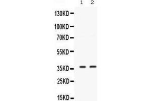 Western blot analysis of SIX1 expression in MCF-7 whole cell lysates (lane 1) and 22RV1 whole cell lysates (lane 2). (SIX Homeobox 1 antibody  (C-Term))