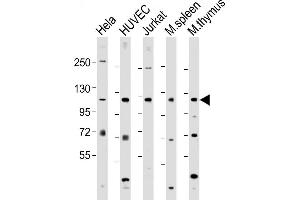 All lanes : Anti-DDX58 C-term  at 1:2000 dilution Lane 1: Hela whole cell lysate Lane 2: HUVEC whole cell lysate Lane 3: Jurkat whole cell lysate Lane 4: mouse spleen lysate Lane 5: mouse thymus lysate Lysates/proteins at 20 μg per lane. (DDX58 antibody  (C-Term))