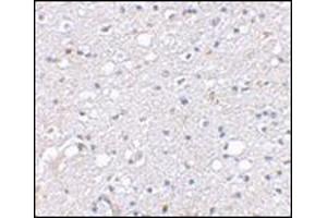 Immunohistochemical staining of human brain tissue using AP30786PU-N at 2. (SIRT2 antibody  (N-Term))