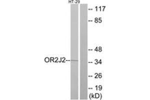 Western blot analysis of extracts from HT-29 cells, using OR2J2 Antibody. (OR2J2 antibody  (AA 263-312))