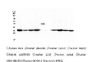 Western blot analysis of Emerin using anti-Emerin antibody .