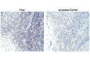Immunohistochemistry (IHC) image for anti-T-Bet antibody (ABIN967672) (T-Bet antibody)