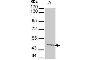 WB Image Sample A: 30μg of A431 whole cell lysate , 7. (Medium-Chain Specific Acyl-CoA Dehydrogenase, Mitochondrial (MCAD) (Center) antibody)